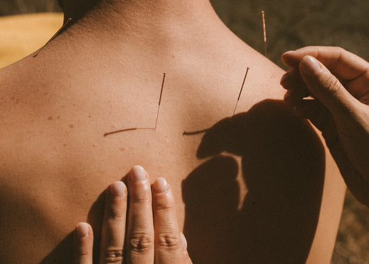 The Acupuncture Package (45 min)